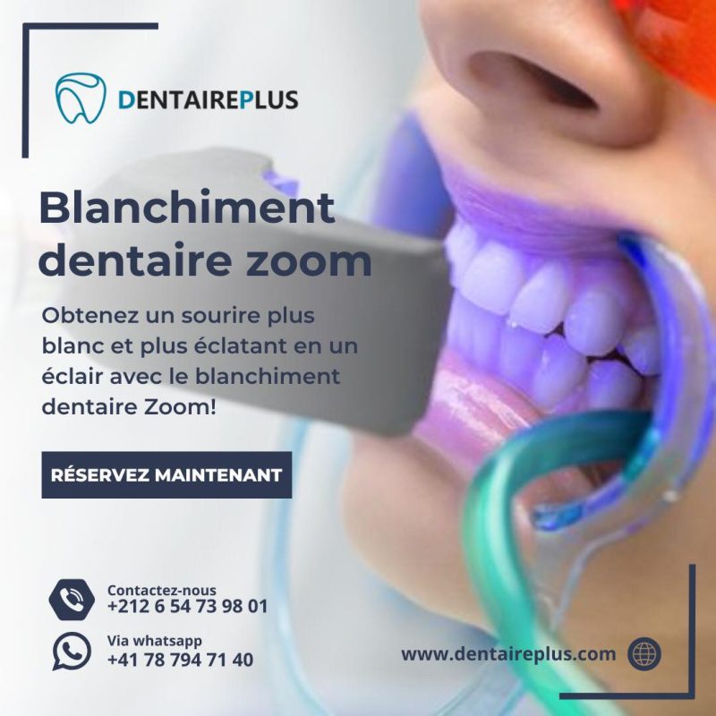 blanchiment dentaire zoom tanger