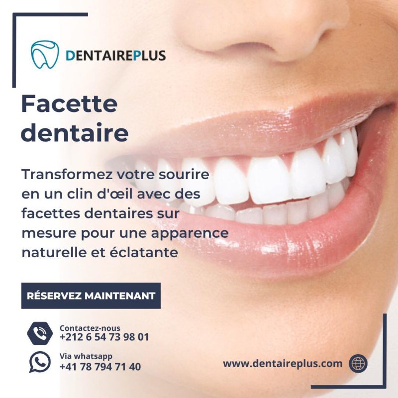 facette dentaire tanger